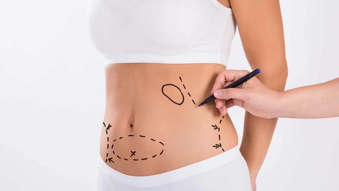 Where can get the simplest abdominoplasty treatment in India?