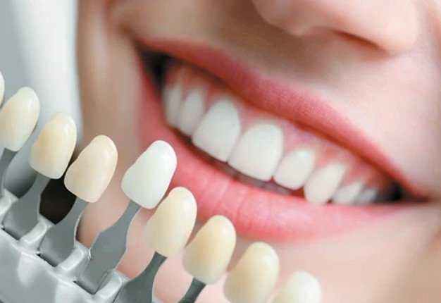 Procedures in Cosmetic and Family Dentistry: An Overview